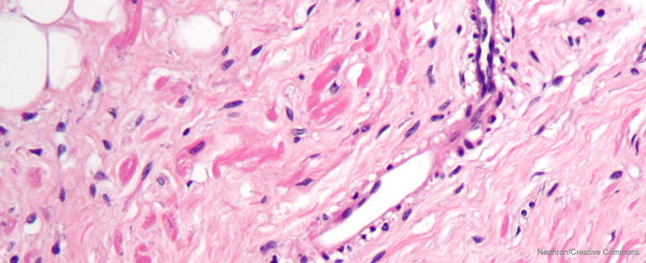 cardiac tissue